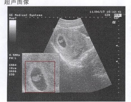 早孕试纸一深一浅就一定怀孕了吗,早孕试纸一深一浅怎么回事