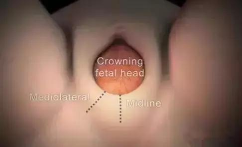 顺产分娩全过程想顺产的你一定想知道！