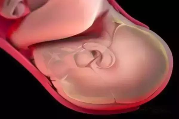 顺产分娩全过程想顺产的你一定想知道！