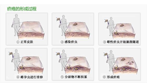五种树皮治皮肤病,七种树枝熬水治皮肤病是真的吗