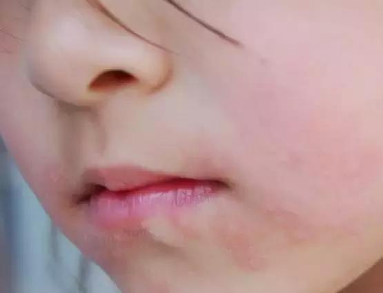 宝宝吃了黄瓜,宝宝吃了黄瓜为什么咳嗽