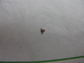 阴虱这种病，谁得谁知道，那酸爽能记一辈子！