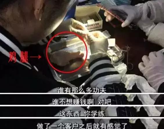 注射玻尿酸会导致鼻子歪吗,玻尿酸打太多鼻子变成阿凡达