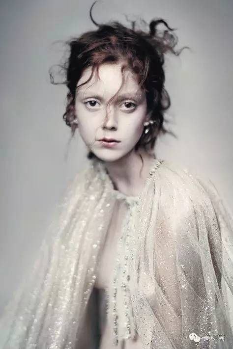 植发际线的亲身体验,亲身体验植发经历