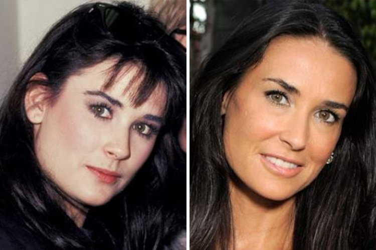 够买15辆最高配5系宝马！好莱坞明星整形整“疯”了