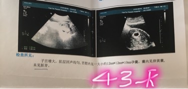 做四维医生说宝宝胎动幅度不大,四维胎动频繁和不怎么活泼对比