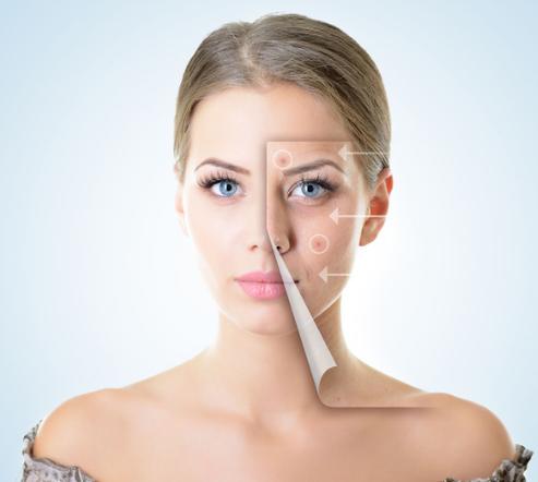 祛黑色痘印最省钱的办法,祛黑头痘痘痘印最省钱的途径