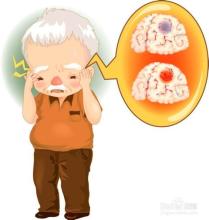 脑梗超过6小时怎么治疗,脑梗6小时溶栓治疗