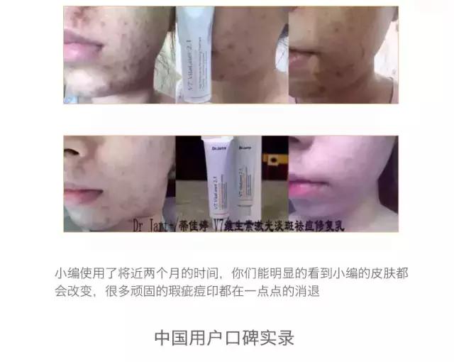 祛痘疤痘印粉刺，Dr.Jart韩国蒂佳婷V7维生素修复霜