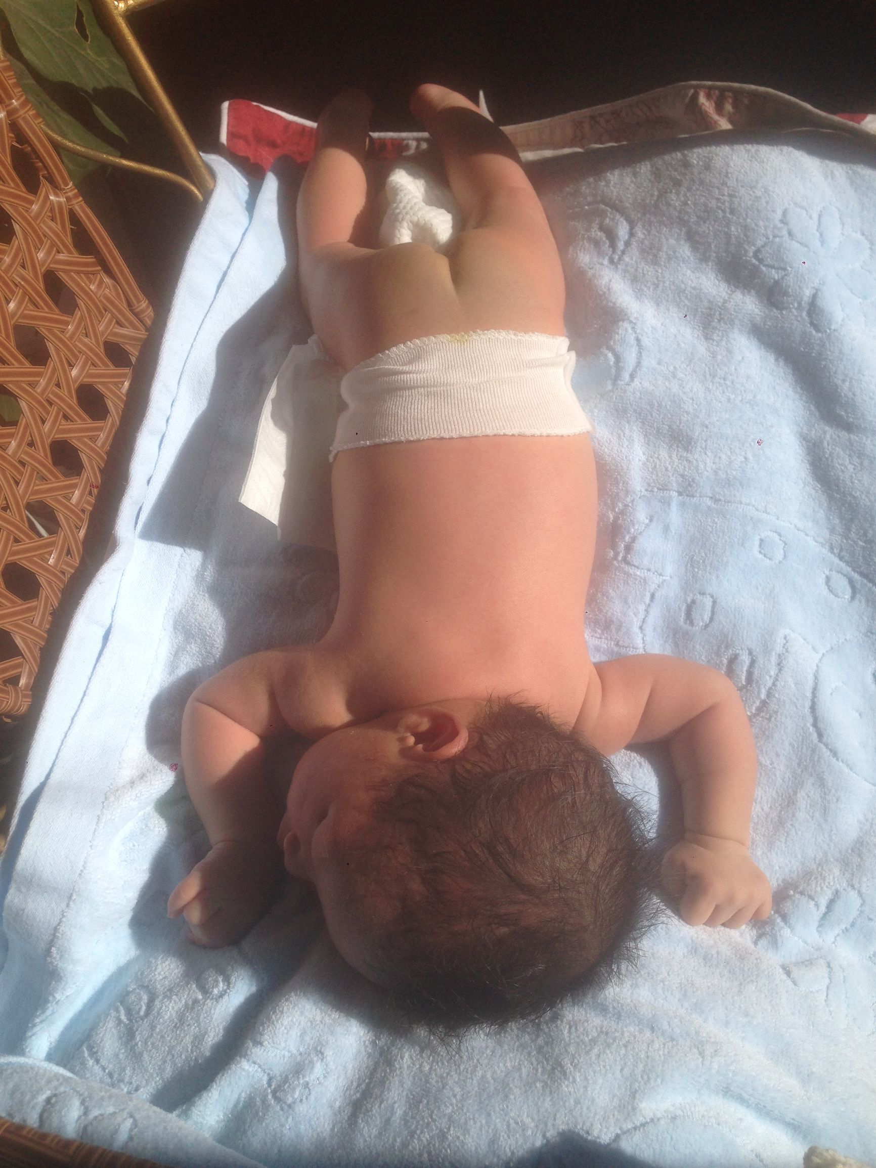 新生儿黄疸的妈妈吃什么药,茶籽油能治新生儿黄疸吗