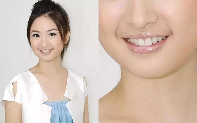 雷人的汗毛曾经重创她们颜值