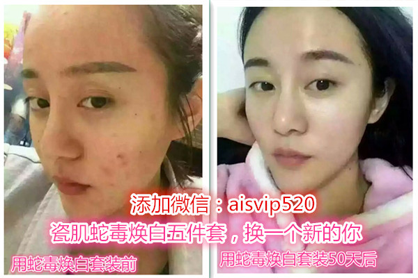 祛痘印最有效的方法小妙招,祛痘印最有效的方法小视频