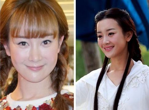 张美嘉爱情公寓,爱情公寓里一菲美嘉整容