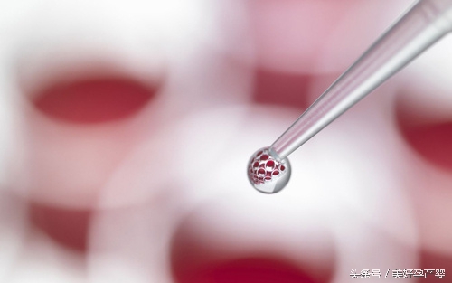 脐带血要不要留,脐带血究竟要不要保留