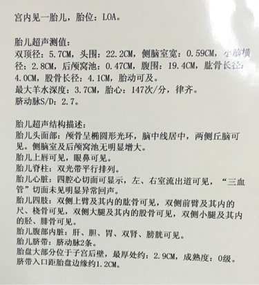 做四维医生说宝宝胎动幅度不大,四维胎动频繁和不怎么活泼对比