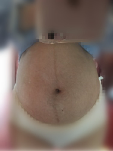 做四维医生说宝宝胎动幅度不大,四维胎动频繁和不怎么活泼对比