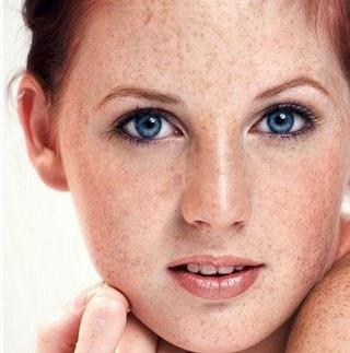 色斑和色素有什么区别,色斑和色斑区别