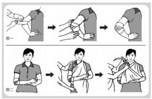 三种包扎法的注意事项,受伤各种包扎法