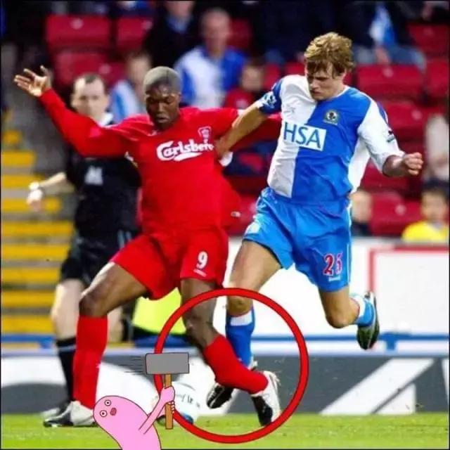 盘点足坛那些断腿瞬间,足坛十大断腿惨案