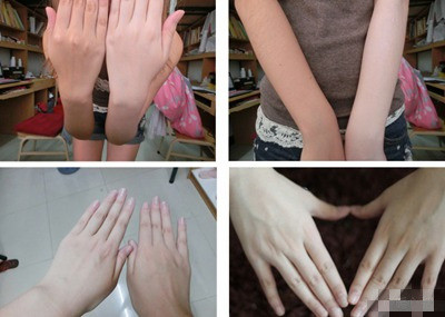 如何拯救晒伤的肌肤,我该如何拯救你