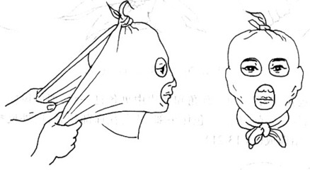 三种包扎法的注意事项,受伤各种包扎法