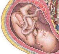 婴儿脐带绕颈迷信说法好吗,宝宝脐带绕颈导致缺氧生下来没哭