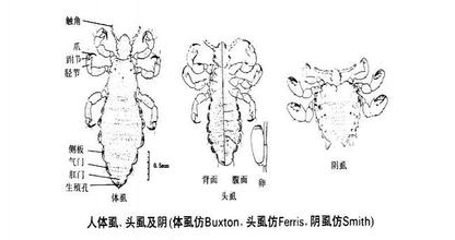 阴虱这种病，谁得谁知道，那酸爽能记一辈子！