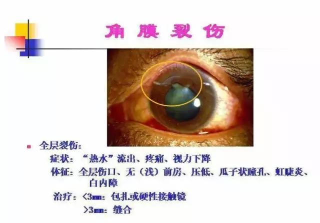 同仁医院韩崧眼外伤后遗症,北京同仁医院韩崧挂号时间