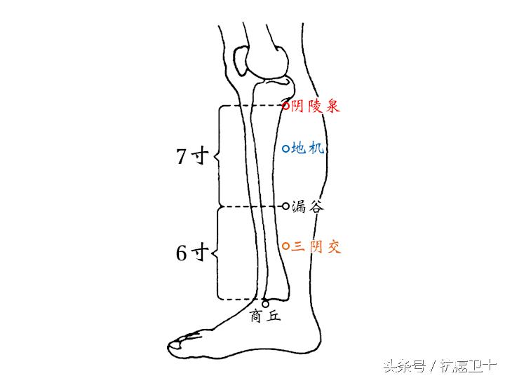 治水肿最好的针灸方法,三皇穴治疗双下肢水肿