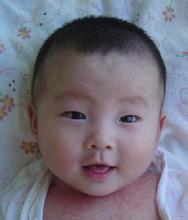 怎么能预防湿疹复发的方法,如何有效地预防湿疹的复发