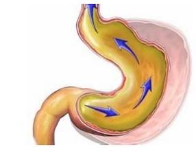 胃胀反酸嗳气消化不良吃什么胃药,胃酸胃胀反酸水烧心吃哪种胃药