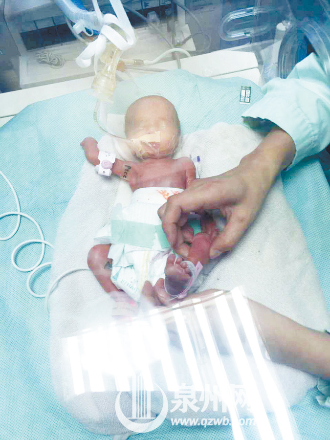 38岁高龄初产妇顺利产下健康宝宝,38岁产妇意外怀二胎完整版