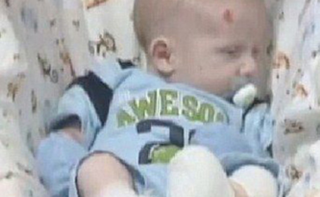 胎儿颈部无包块皮肤水肿什么意思,三个月胎儿全身皮肤水肿的原因