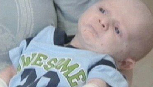 胎儿颈部无包块皮肤水肿什么意思,三个月胎儿全身皮肤水肿的原因