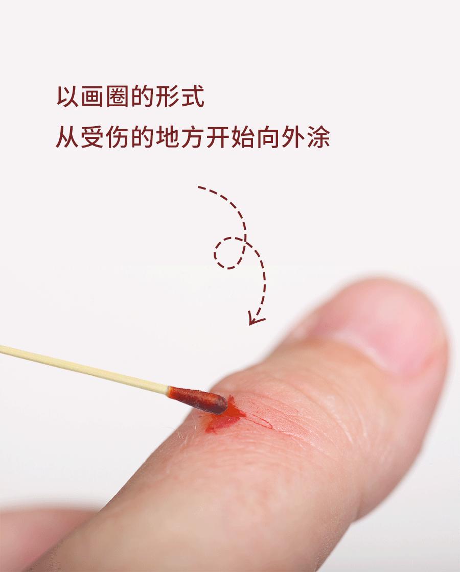 擦伤敷贴,擦伤后消毒贴创口贴