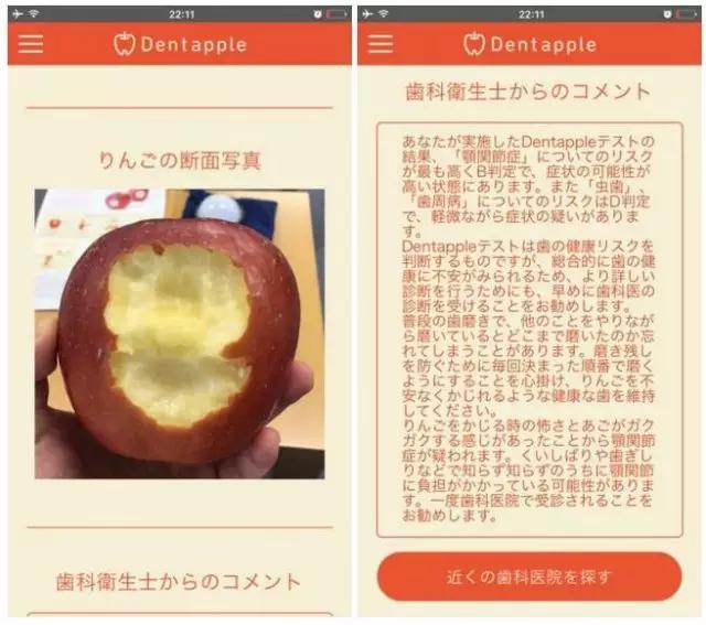 最牛逼苹果,苹果可以治疗牙齿吗