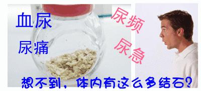 夏天,别让您的“下水道”总长石头