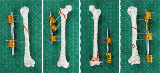 国外骨科医生手术工具,外军专家