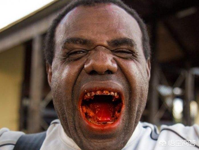 嚼槟榔几年有可能得口腔癌,嚼槟榔的危害口腔癌患者