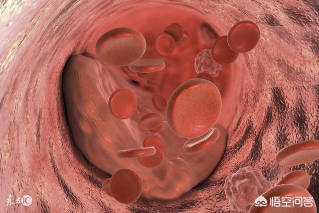 心脏溶栓和支架的区别是什么,心脏溶栓和支架的区别