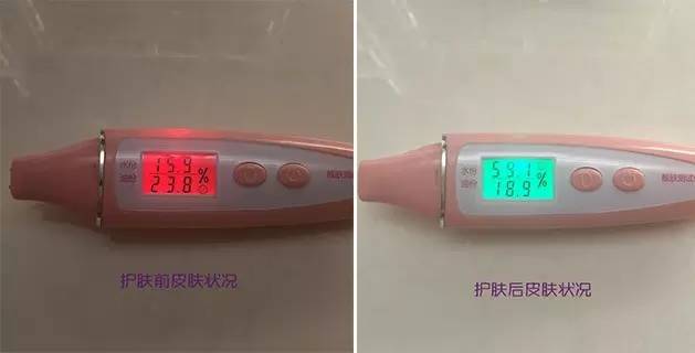 洁面仪开箱大测评一起来看看吧,美容仪洁面仪哪个有必要入手