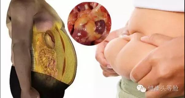 内脏脂肪高影响新陈代谢速度,内脏脂肪上升一级意味着瘦了多少