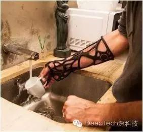 骨头断了不用打石膏，来个3D打印保护套就行，但是很贵哦