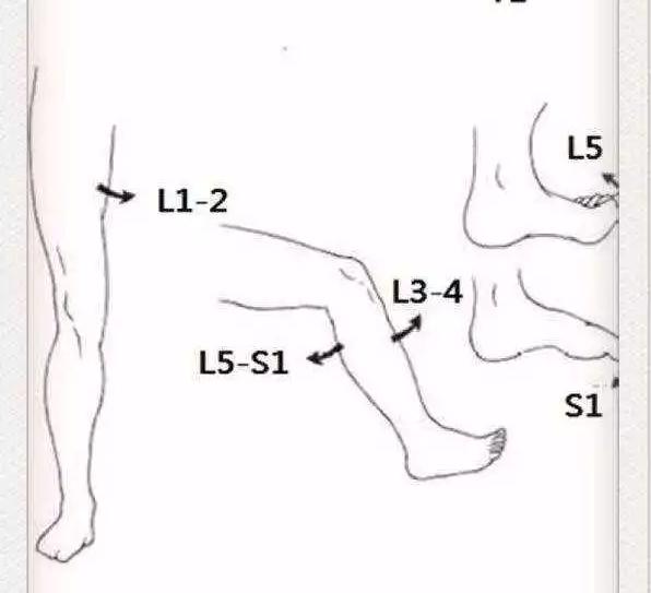 医生看颈椎病的图片,颈椎胸椎腰椎尾椎图解全图