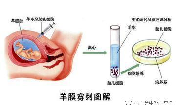 孕检时的各种问题,孕检三大注意事项