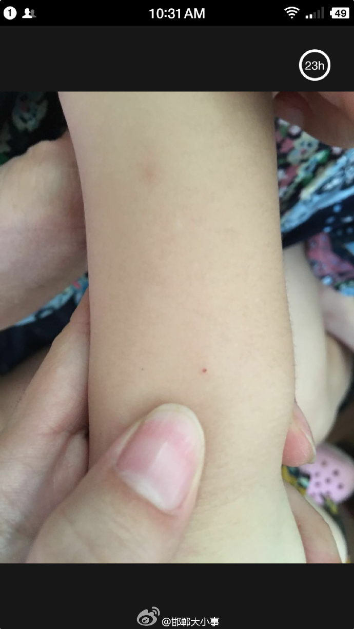 河南一幼儿园针扎小朋友事件,朔州幼儿园针扎幼儿事件