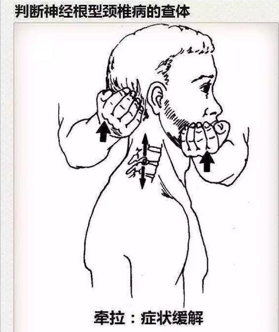 医生看颈椎病的图片,颈椎胸椎腰椎尾椎图解全图