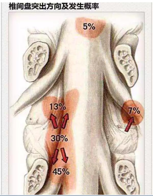 医生看颈椎病的图片,颈椎胸椎腰椎尾椎图解全图
