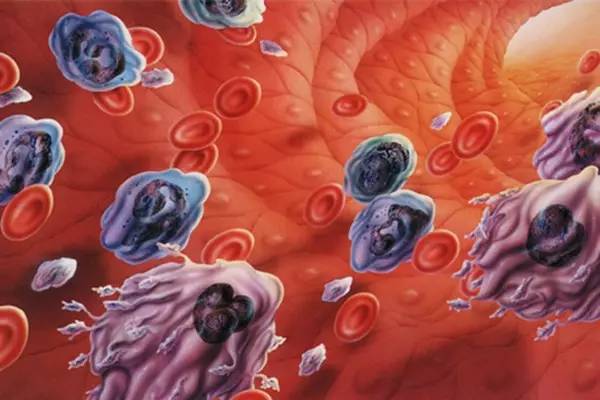 血粘和血稠有什么区别,血粘好治吗