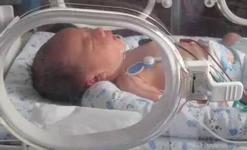 父母应该高度重视的新生儿肺炎！